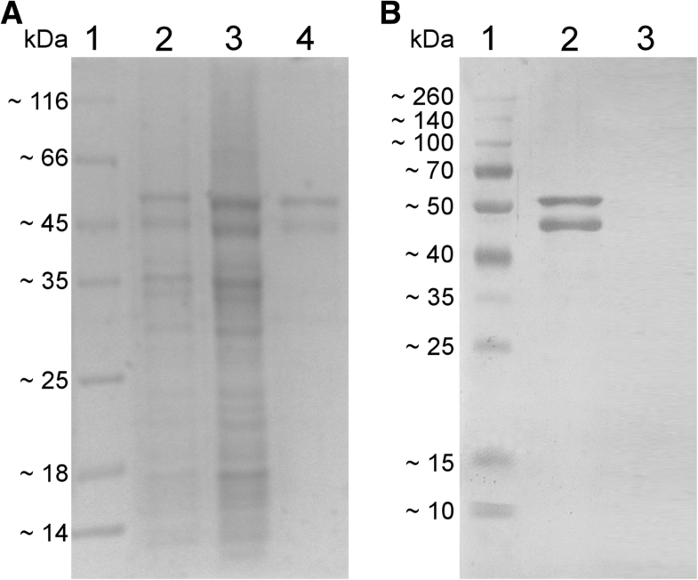 Combined use of ELISA and Western blot with N protein is a