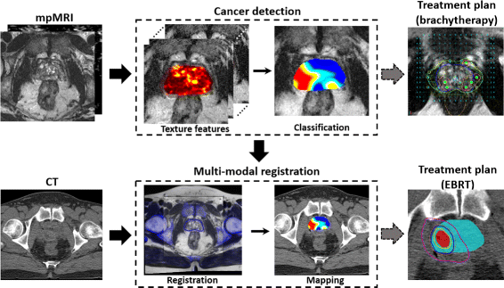 Radiomics based targeted radiotherapy planning (Rad-TRaP ...