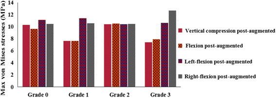 Biomechanical effects of different vertebral heights after augmentation
