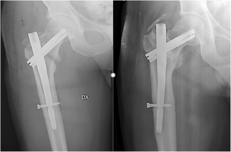 tad gerlinger orthopaedic surgery tad gerlinger orthopaedic surgery