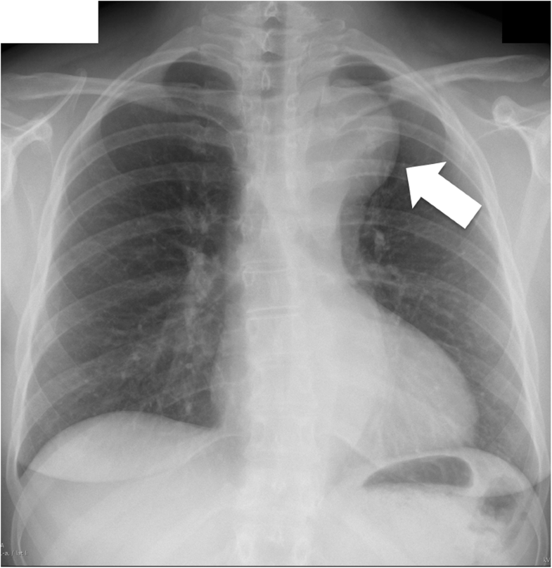 Literature review chest x ray image