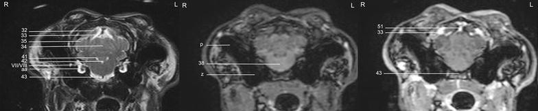 Magnetic resonance imaging anatomy of the rabbit brain at 3 T | Acta