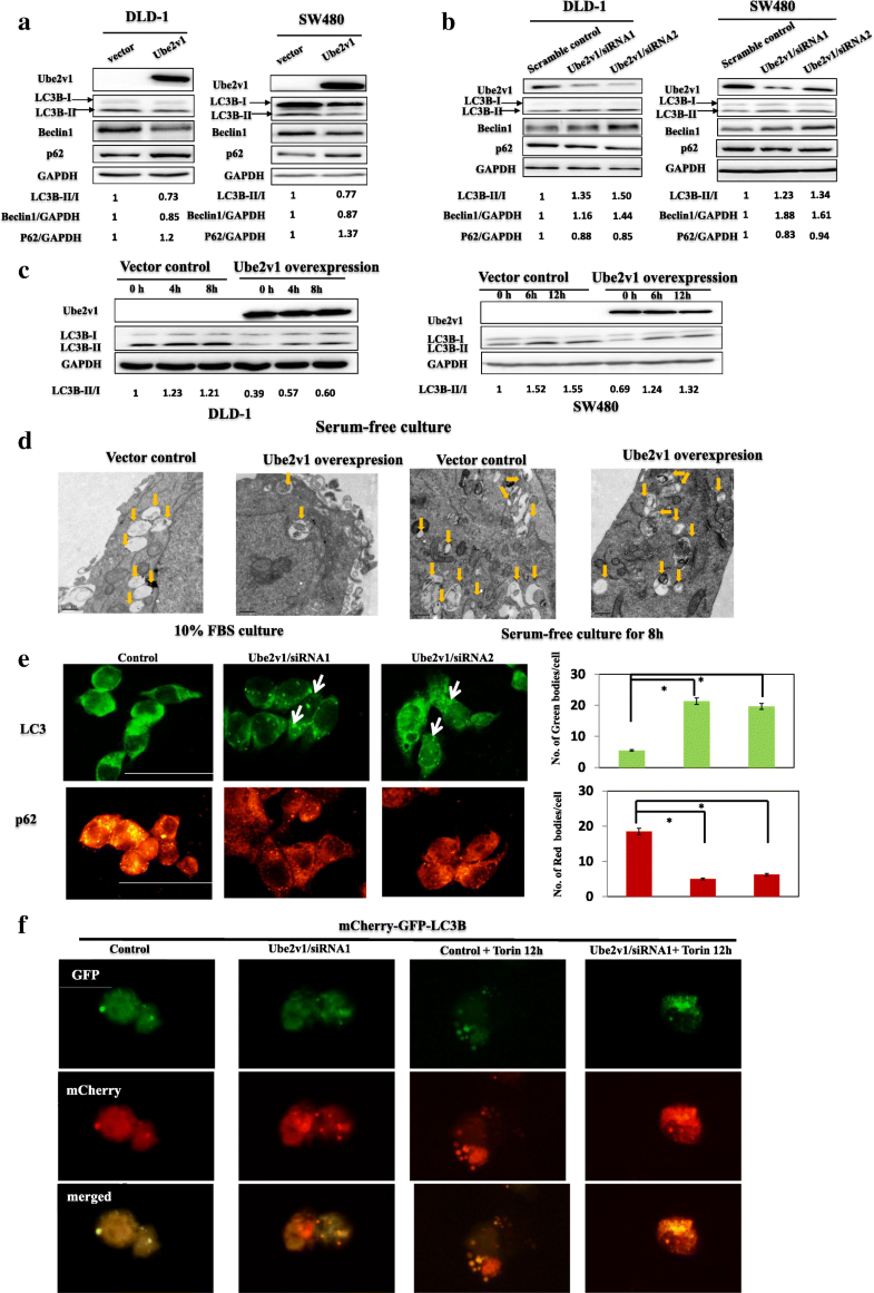 degradation of sirt1 promotes metastasis of colorectal cancer by