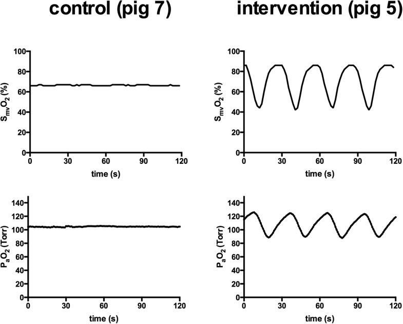 PO2 oscillations induce lung injury and inflammation Critical Care Full Text