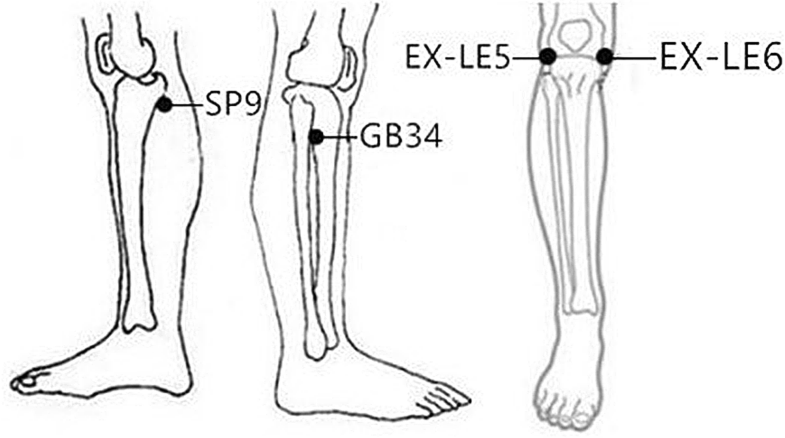 The cerebral mechanism of acupuncture for treating knee osteoarthritis ...