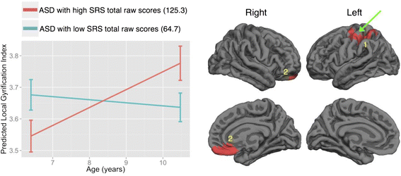 In Autism Brain Shows Unusual Thinning >> Cortical Morphological Markers In Children With Autism A Structural In Autism Brain Shows Unusual Thinning >> Cortical Morphological Markers In Children With Autism A Structural