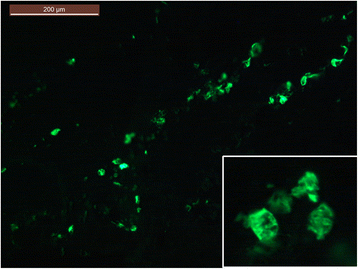 bk diamond cells