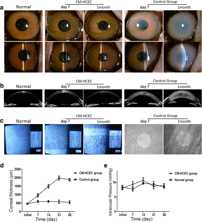 Promoting the expansion and function of human corneal endothelial cells