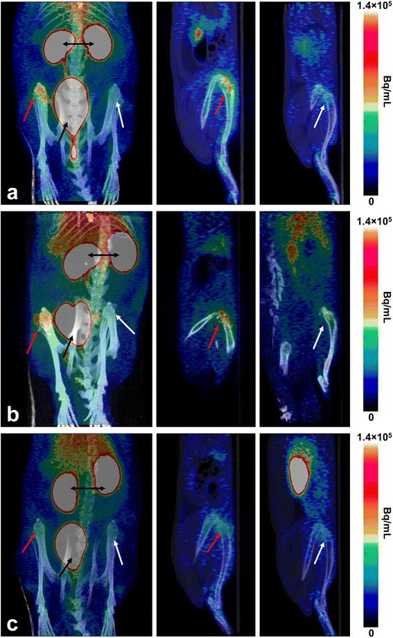 68ga Dota Siglec 9 Pet Ct Imaging Of Peri Implant Tissue Responses