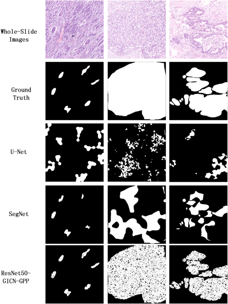 Largescale tissue histopathology image segmentation based on feature