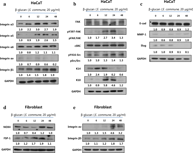 The wound healing effect of four types of betaglucan Applied