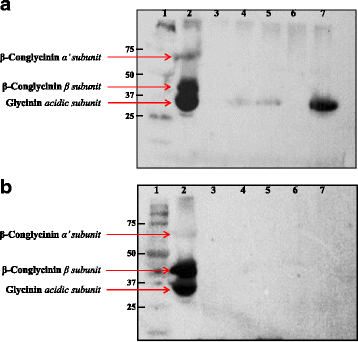 Isolation Of Bacteria From Fermented Food And Grass Carp Intestine