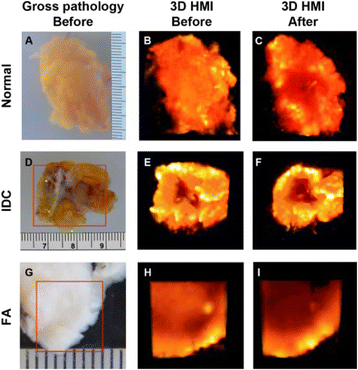 5th International Symposium On Focused Ultrasound Springerlink - 