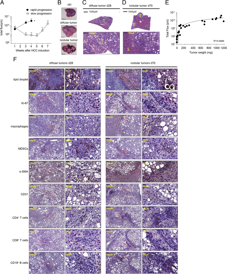 A novel spontaneous hepatocellular carcinoma mouse model for studying T