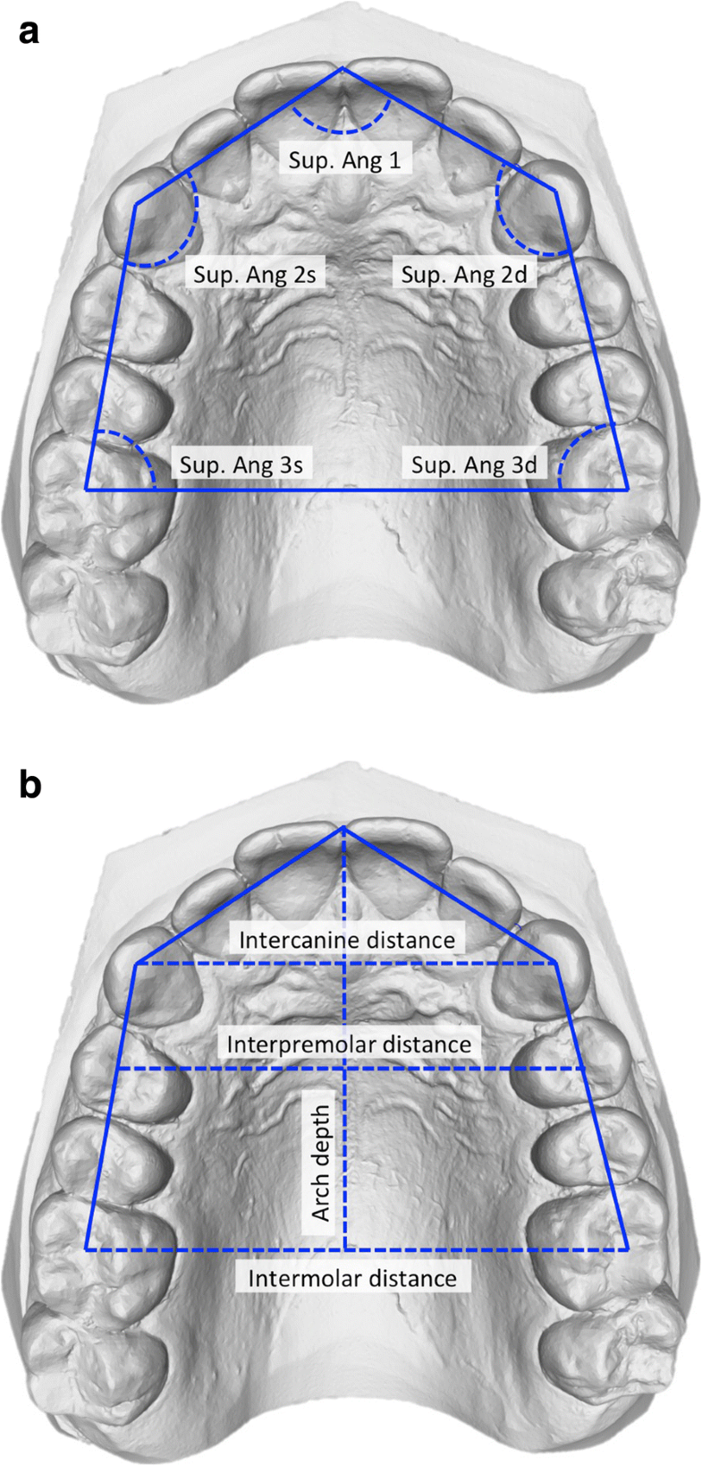 Threedimensional analysis of dental arch forms in Italian population