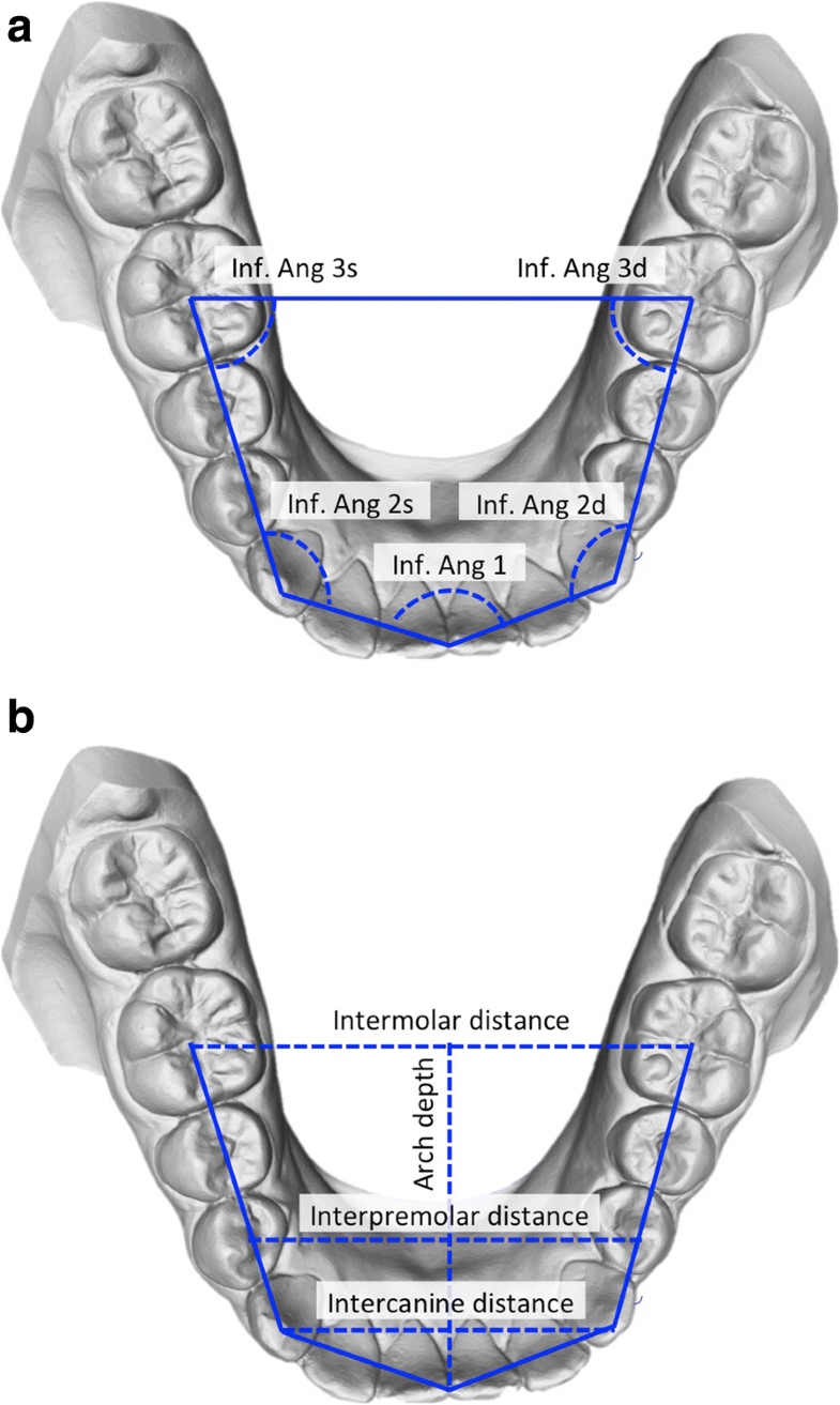 Threedimensional analysis of dental arch forms in Italian population