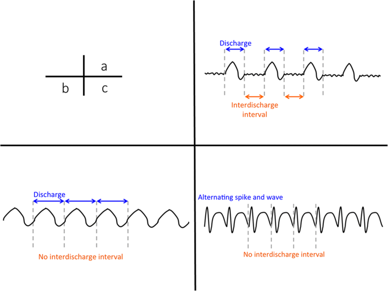 Continuous EEG monitoring in ICU Journal of Intensive Care Full Text