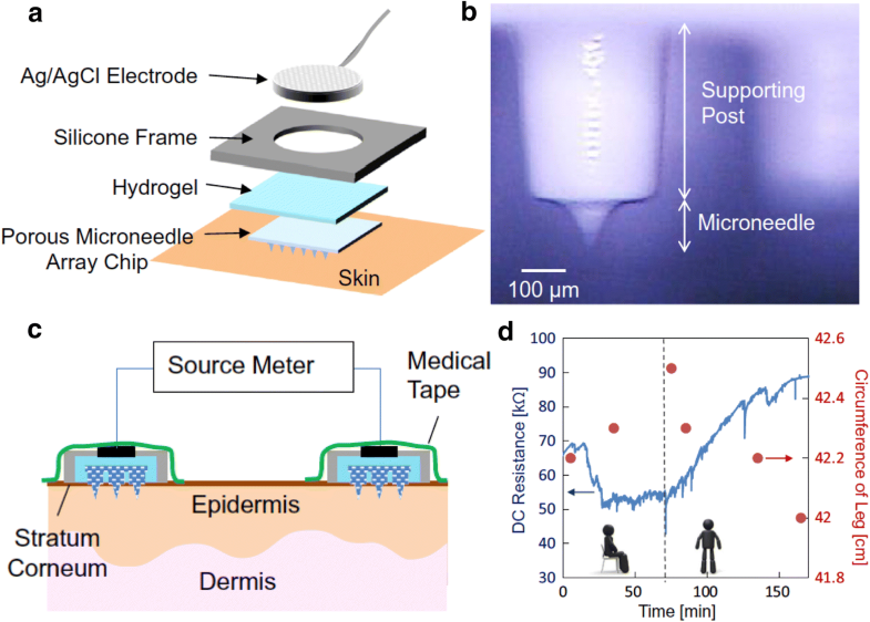 Functionalized microneedles for continuous glucose monitoring Nano