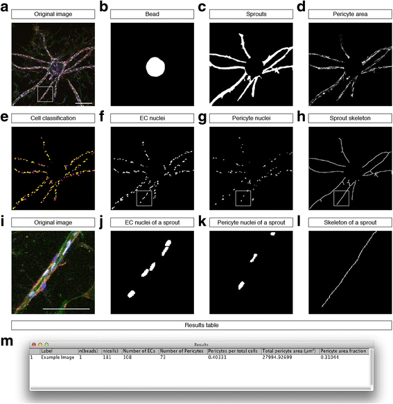 Quantitative Assessment Of Angiogenesis And Pericyte