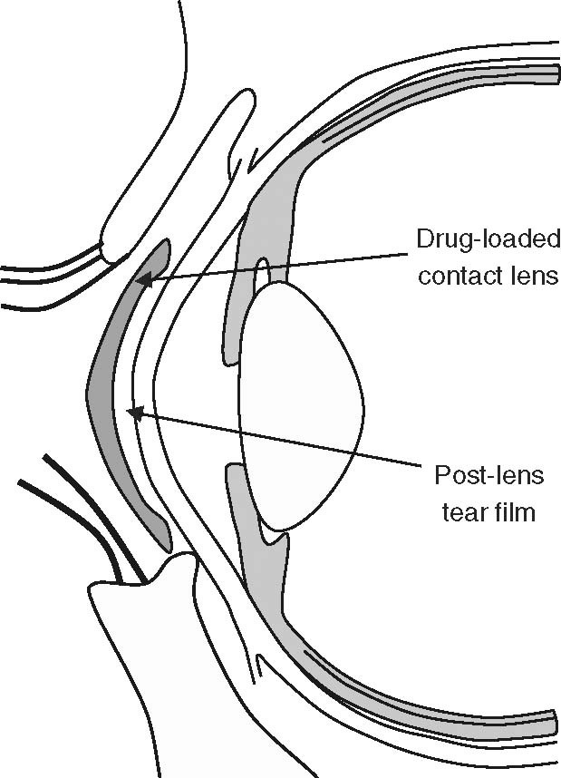 contact lenses for drug