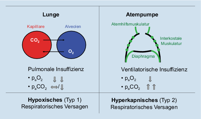 Monitoring des pCO2 unter Beatmung SpringerLink
