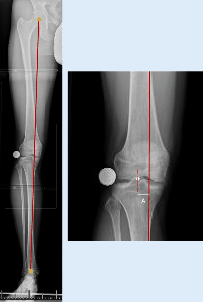 Präoperative bildgebende Diagnostik und Planung | SpringerLink