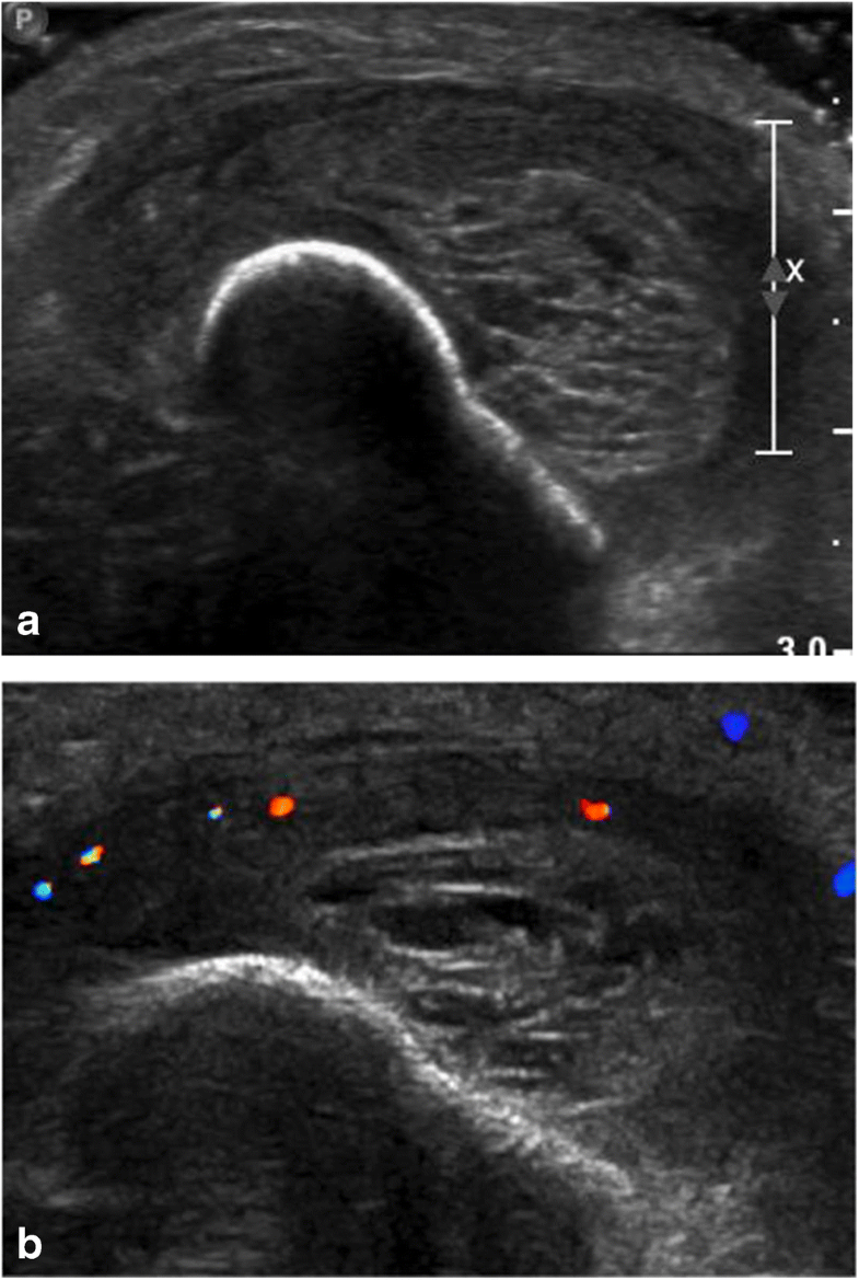 Test Yourself Question “Painless right leg swelling” SpringerLink