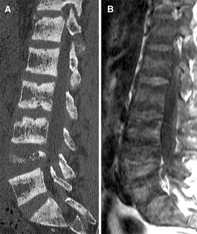 The rugger jersey spine | SpringerLink