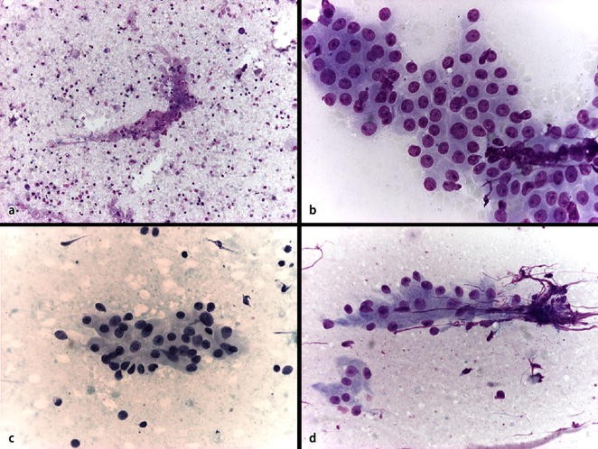 Zytologie der Speicheldrüsentumoren | SpringerLink
