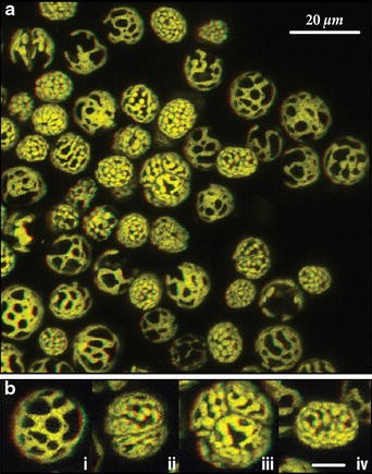 The reticulated chloroplasts of zooxanthellae ( Symbiodinium) and