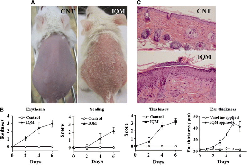 Assessment of an imiquimod-induced psoriatic mouse model in relation to ...