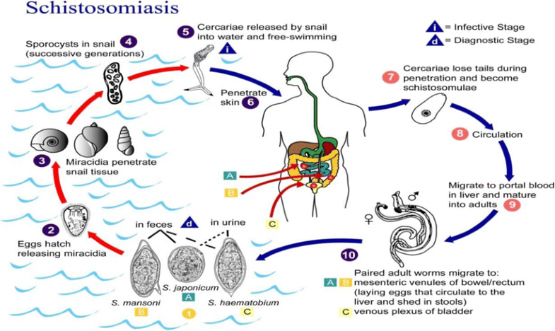 Urinary schistosomiasis | SpringerLink