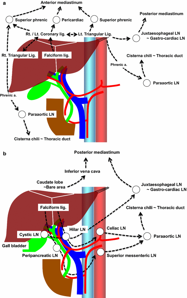 The value of systematic lymph node dissection for intrahepatic