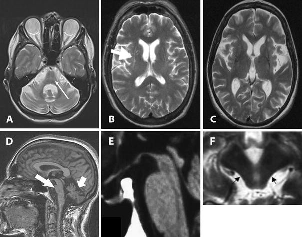 Magnetic resonance imaging for the diagnosis of Parkinson’s disease ...
