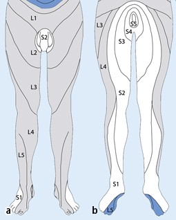 Lumbale Radikulopathie | SpringerLink