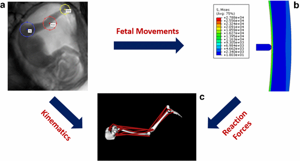 Modeling The Biomechanics Of Fetal Movements | SpringerLink