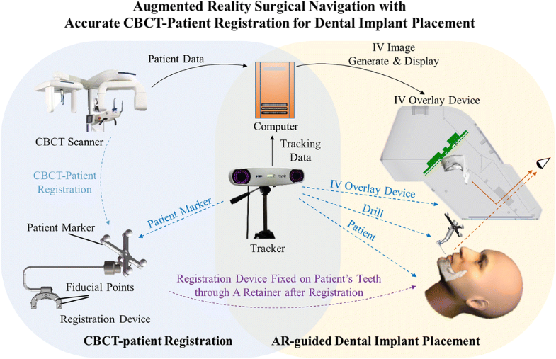 Augmented reality surgical navigation with accurate CBCTpatient