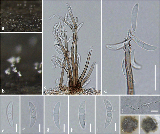 Morphological and molecular taxonomy of novel species Pleurotheciaceae ...