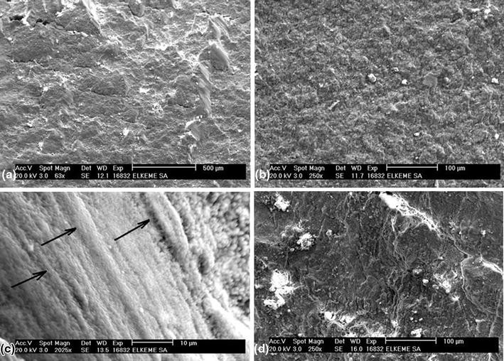 Failure and Fracture Analysis of Austenitic Stainless Steel Marine