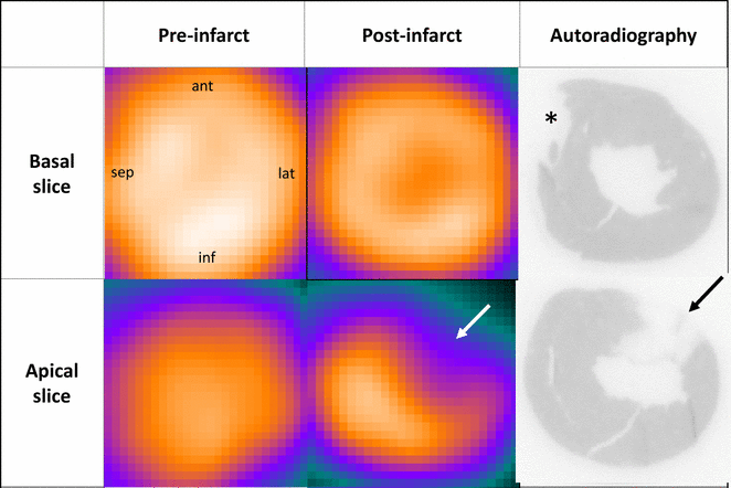 Perfusion imaging using rubidium-82 (82Rb) PET in rats with myocardial ...