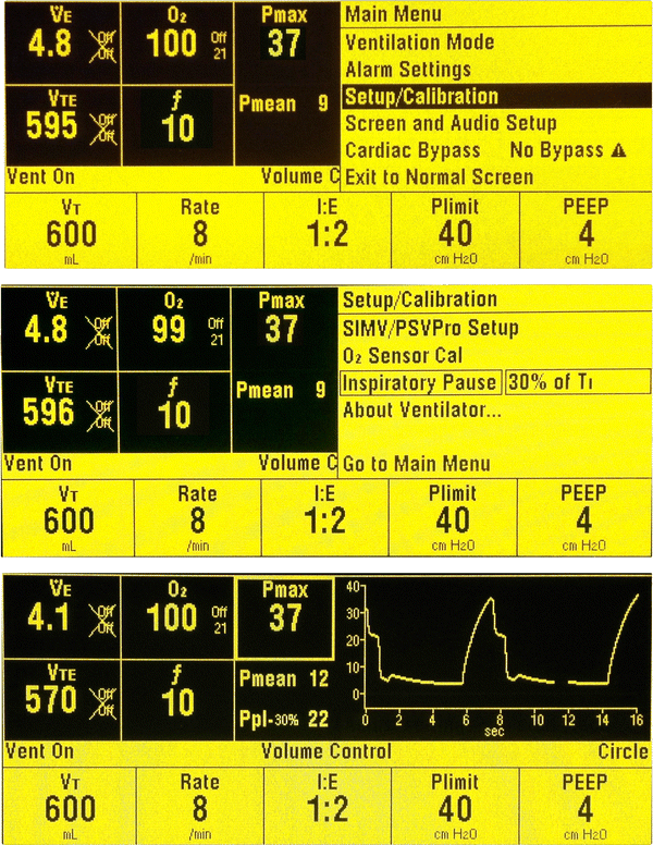 Intraoperative plateau pressure measurement using modern anesthesia machine ventilators