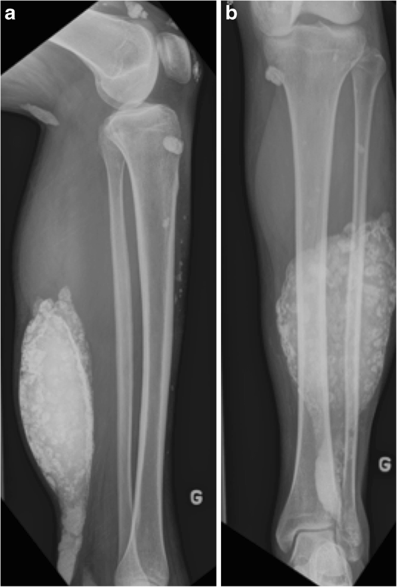 Radiological identification and analysis of soft tissue musculoskeletal