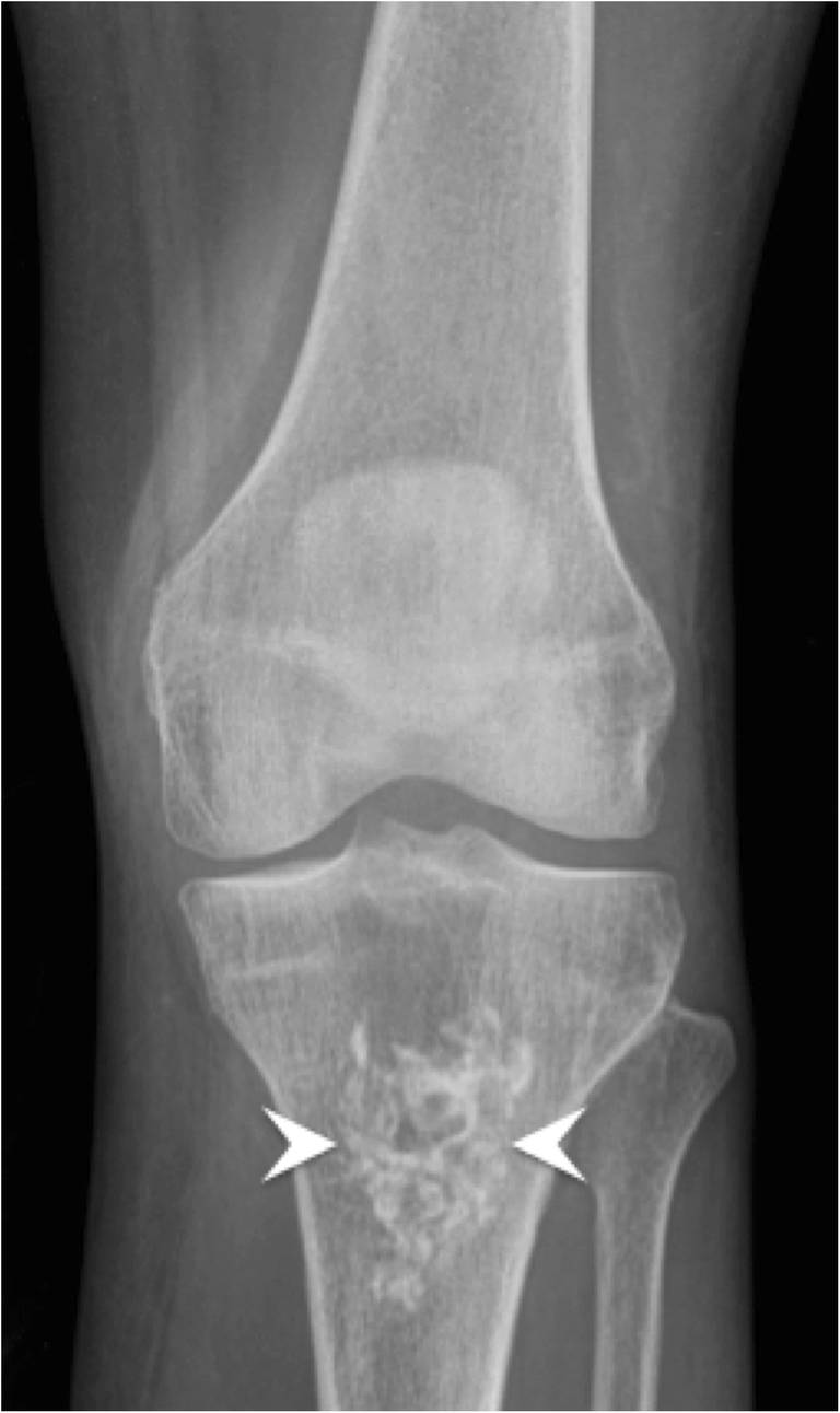 Radiological identification and analysis of soft tissue musculoskeletal