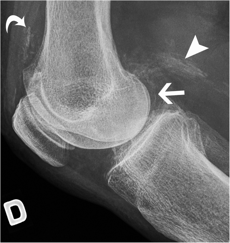Radiological identification and analysis of soft tissue musculoskeletal