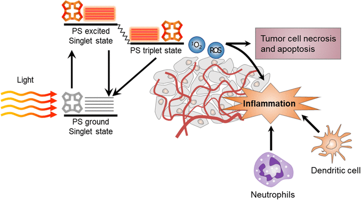 Combination of photodynamic therapy (PDT) and antitumor immunity in
