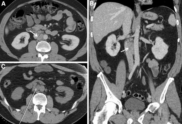 Radiologic Assessment of Lymph Nodes in Oncologic Patients | SpringerLink