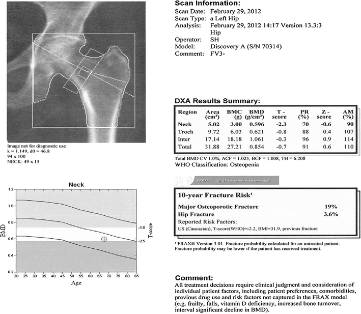 A Practical Approach to Interpretation of Dual-Energy X-ray ...