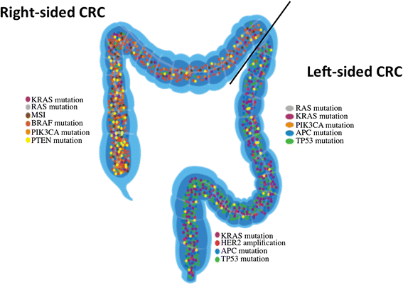 Colorectal Cancer Why Does Side Matter? SpringerLink