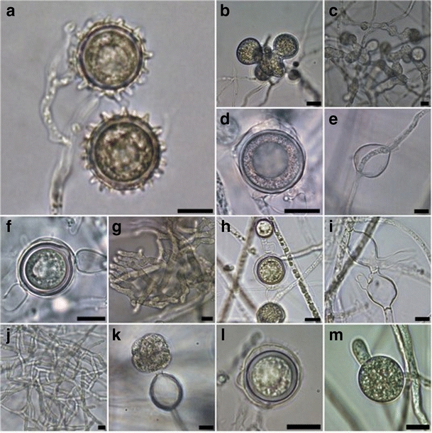 Pythium and Phytopythium species associated with hydroponically grown