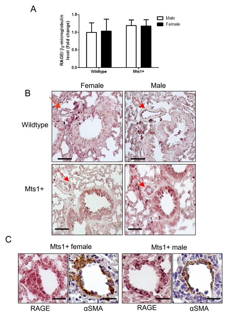 Development of pulmonary arterial hypertension in mice overexpressing